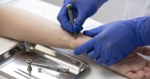 A Brief Guide to Dermal Piercings